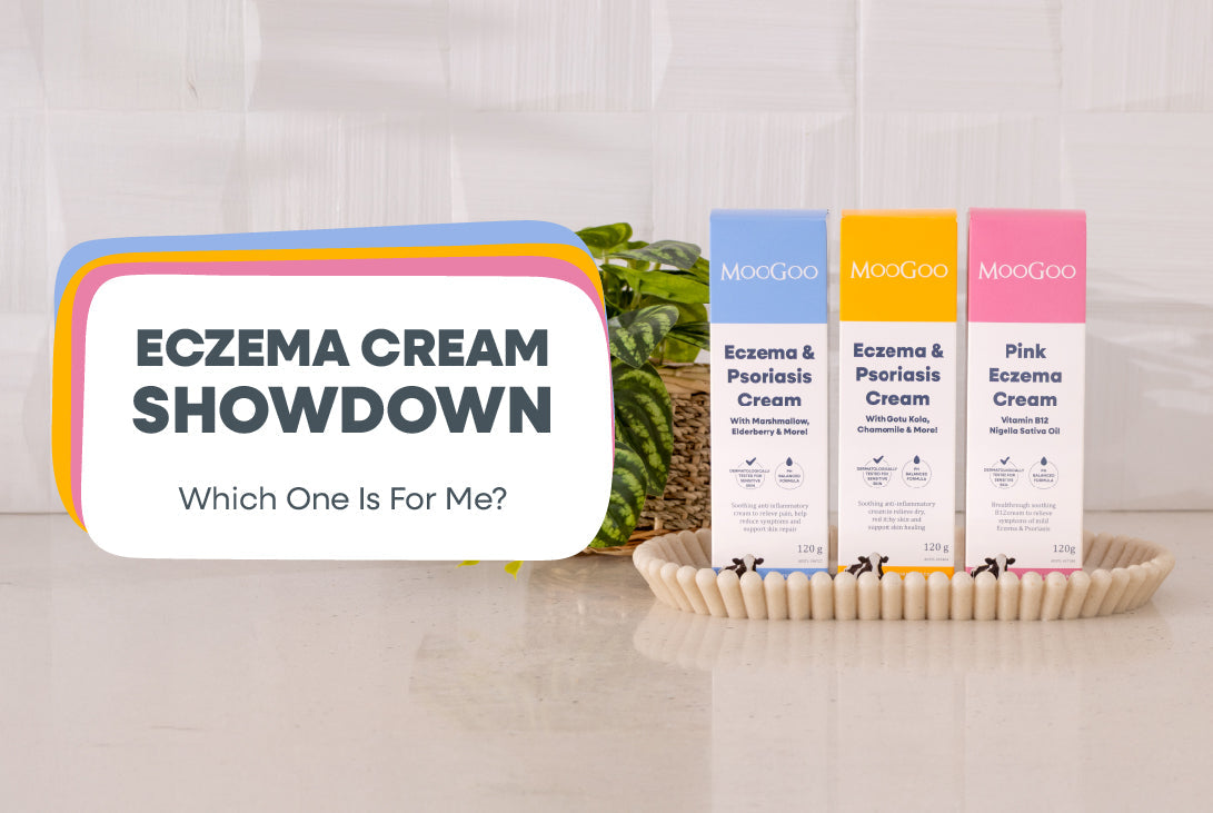 Eczema Cream Showdown: Which One Is For Me?