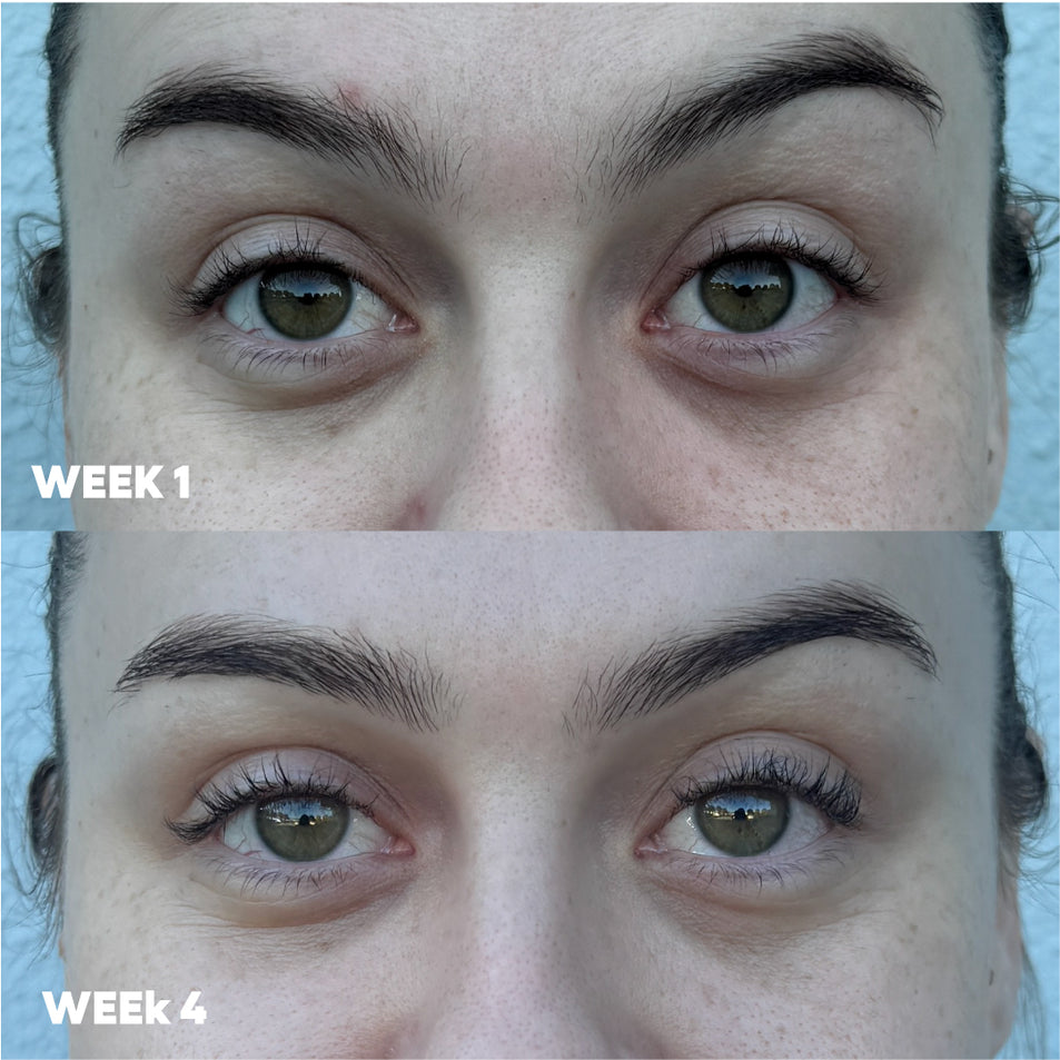 MooGoo 3-in-1 Peptide Eye Serum before & after of a female. Made with Vitamin C, Copper Tri-Peptide, Argireline Amplified and Vitamin K to brighten dark circles, reduce fine lines and wrinkles, and diminish under eye puffiness.